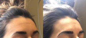 before-after-microblading-eyebrows-10