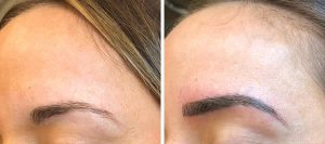 before-after-microblading-eyebrows-2