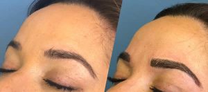before-after-microblading-eyebrows